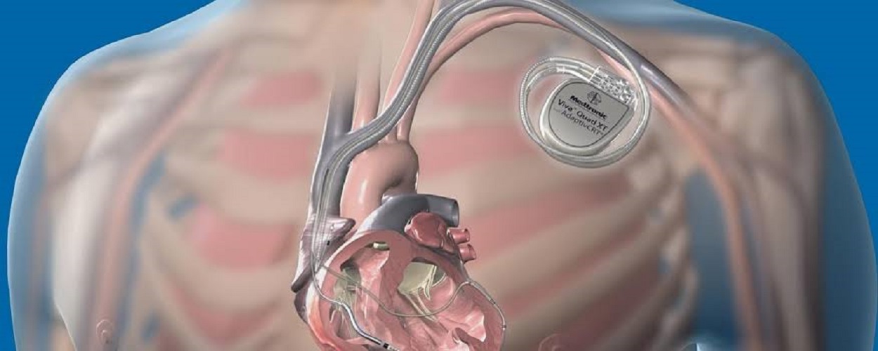 Automatic Implantable Cardiac Defibrillator Banner