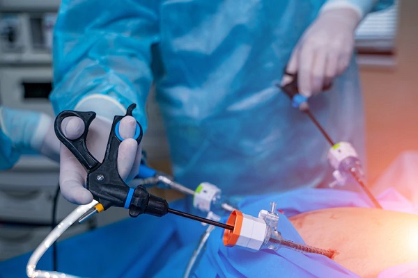 Endoscopy